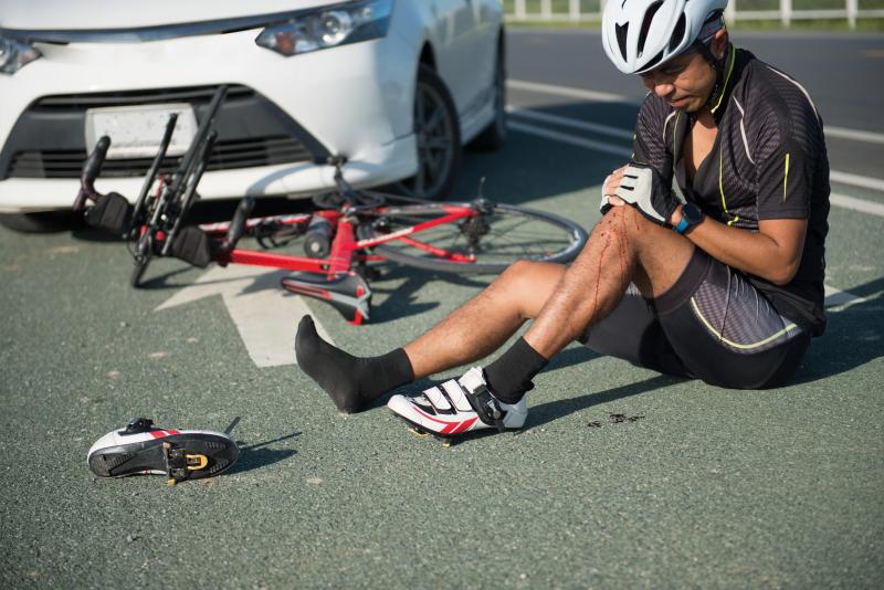 A man is sitting on the road with his legs out in front of him. One leg is bent and he's holding the knee, there is blood on his calf. He is wearing cycling kit. His bike is on the road behind him and behind that is a white car